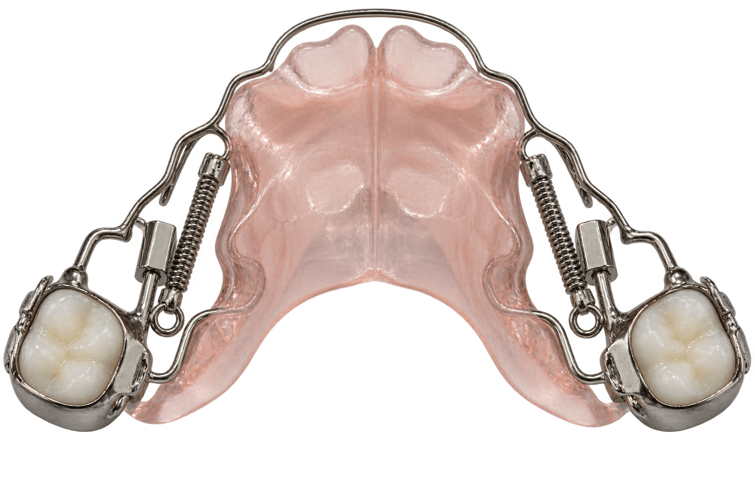 Molar distalizing orthodontic appliance