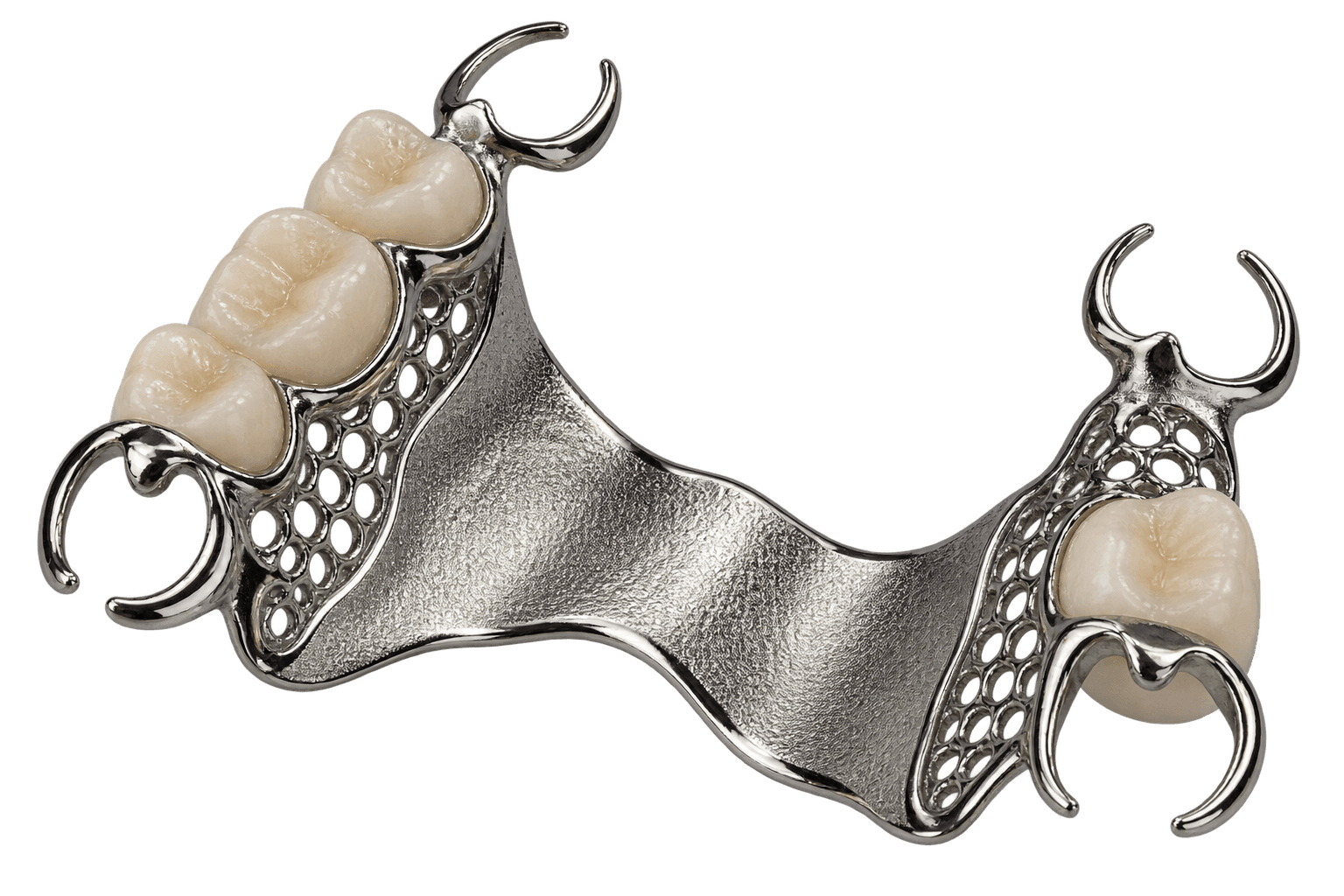 Direct metal printed partial denture framework