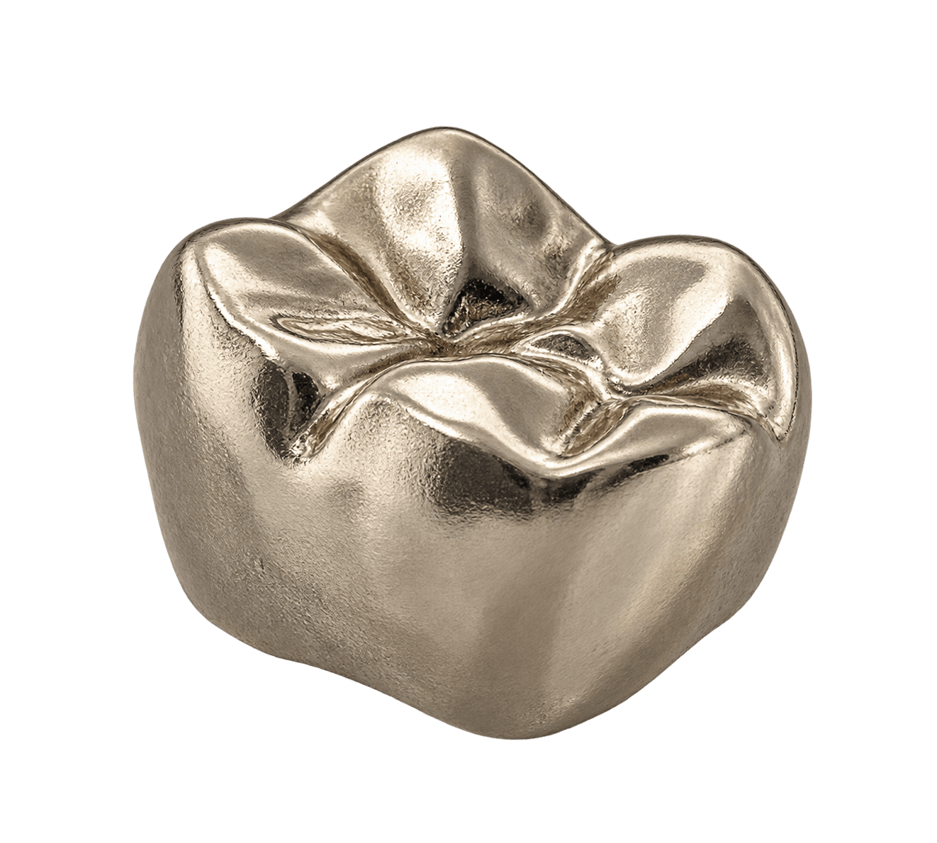Full cast dental restoration